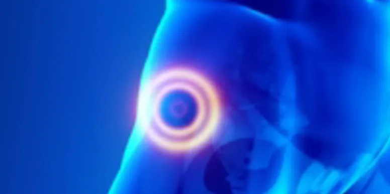 Hip & Groin Injury