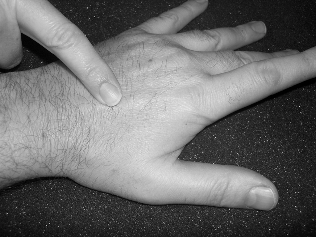 Soft Tissue Injury