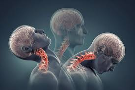 Concussion in Sport