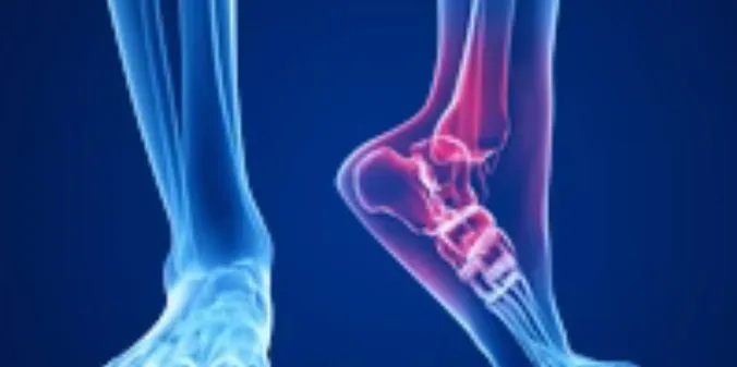 Foot & Ankle Injury