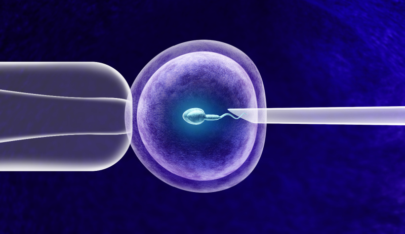 Understanding IVF: A Complete Guide
