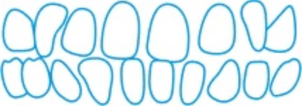 Spacing