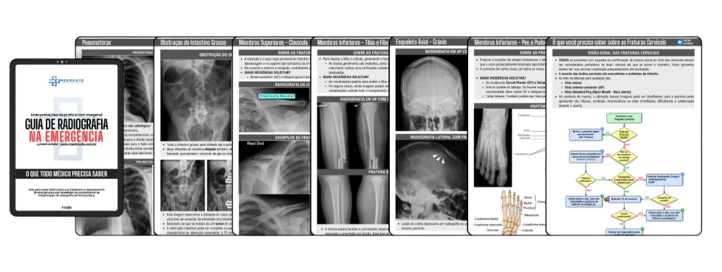 Guia de Radiografia na Emergência