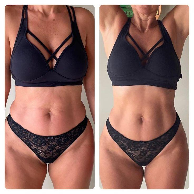 Antes y después - Abdomen · Maderoterapia corporal