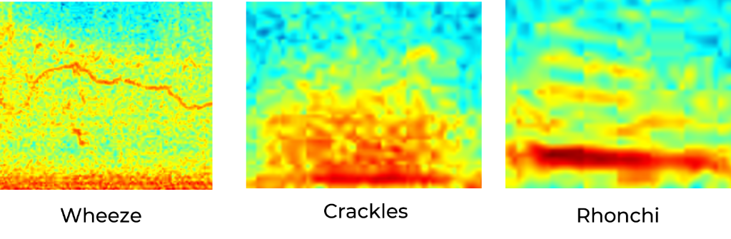 Lung sound spectrograms showing wheeze, crackles, and rhonchi