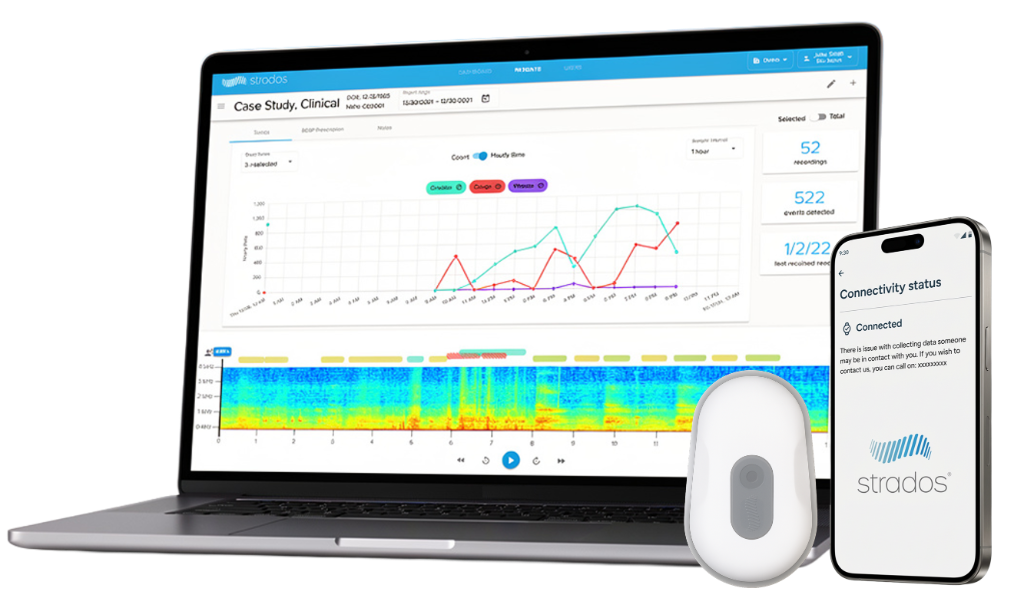 RESP Biosensor system overview