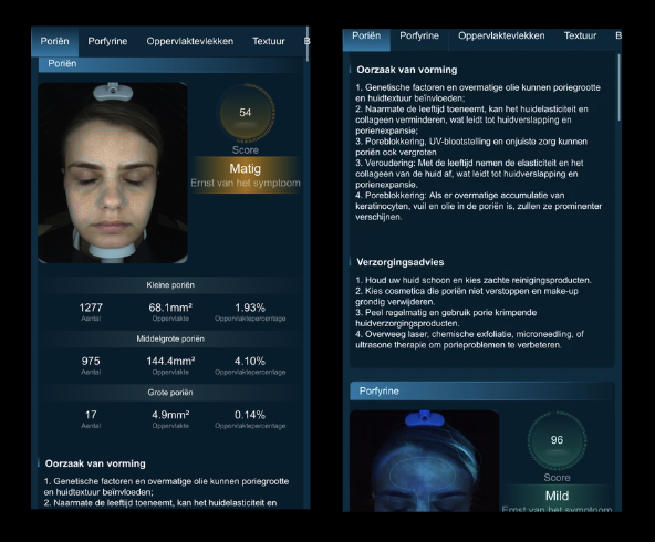 Mobile Report