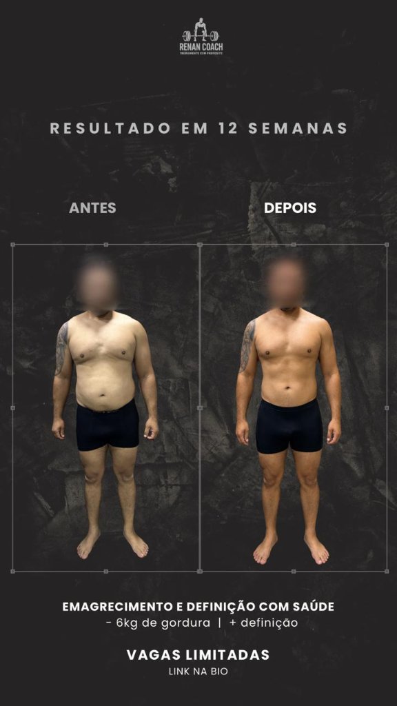 Resultado masculino — aluno-03 — frontal — antes e depois
