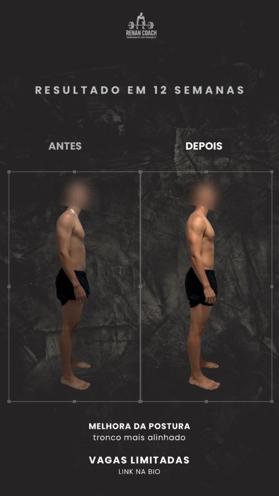 Resultado masculino — aluno-02 — perfil-direito — antes e depois