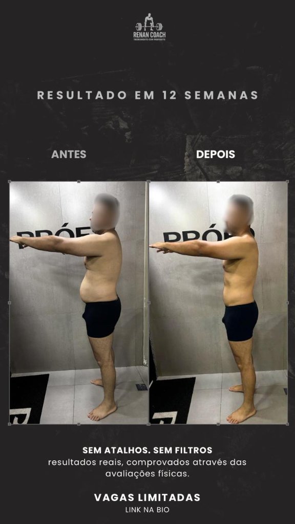 Resultado masculino — aluno-03 — perfil-esquerdo — antes e depois