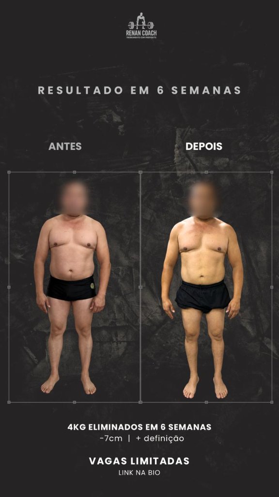 Resultado masculino — aluno-04 — frontal — antes e depois