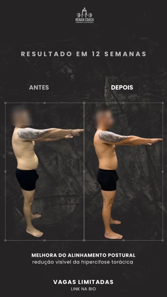 Resultado masculino — aluno-03 — perfil-direito — antes e depois