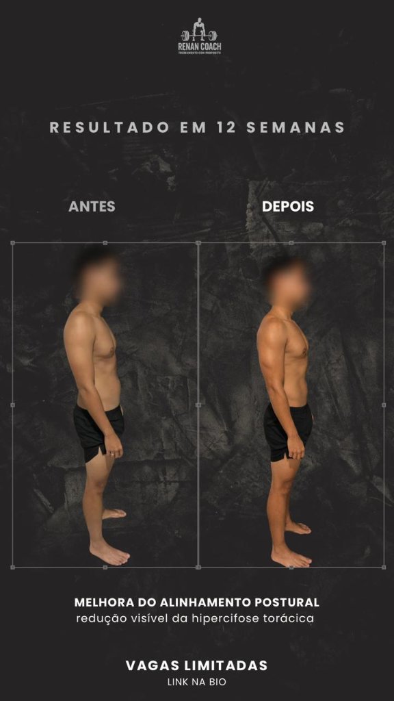 Resultado masculino — aluno-01 — perfil-direito — antes e depois