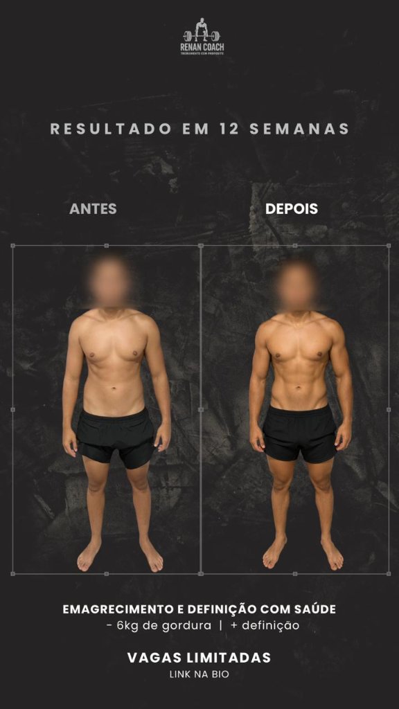Resultado masculino — aluno-01 — frontal — antes e depois