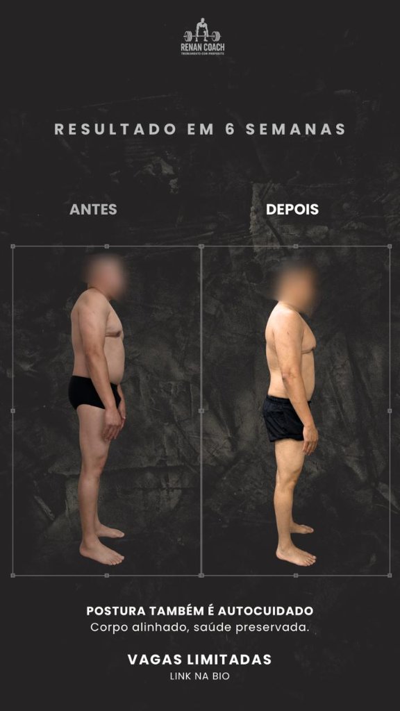 Resultado masculino — aluno-04 — perfil-direito — antes e depois
