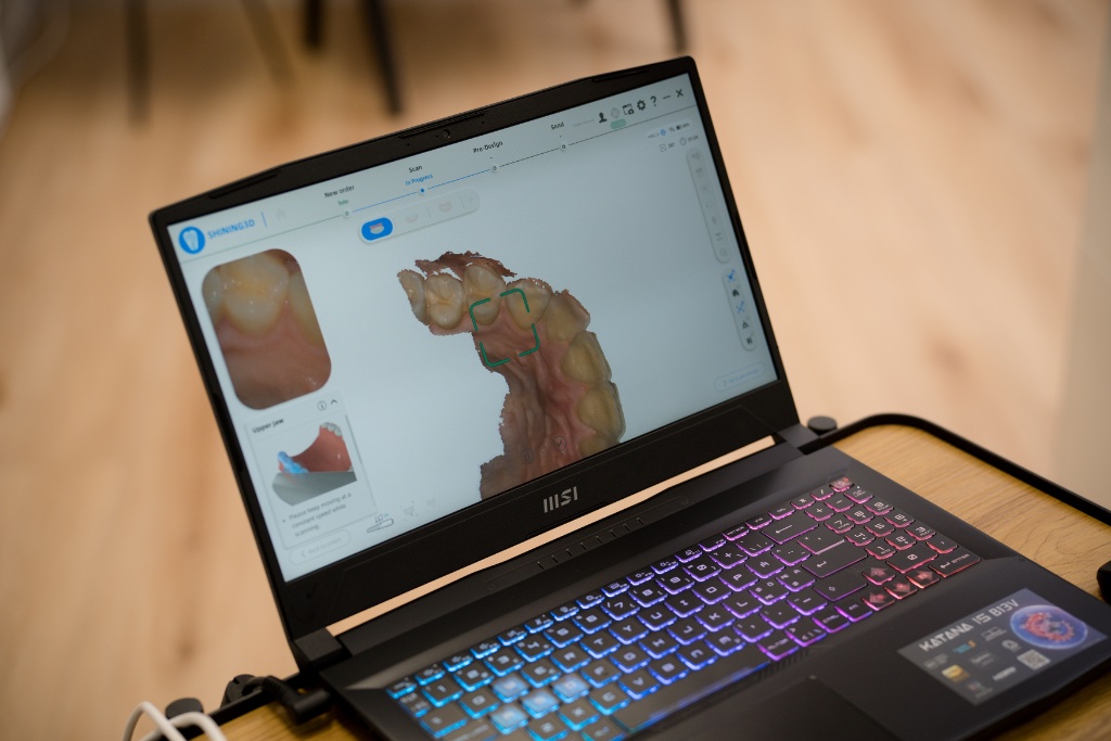 3D-simulering