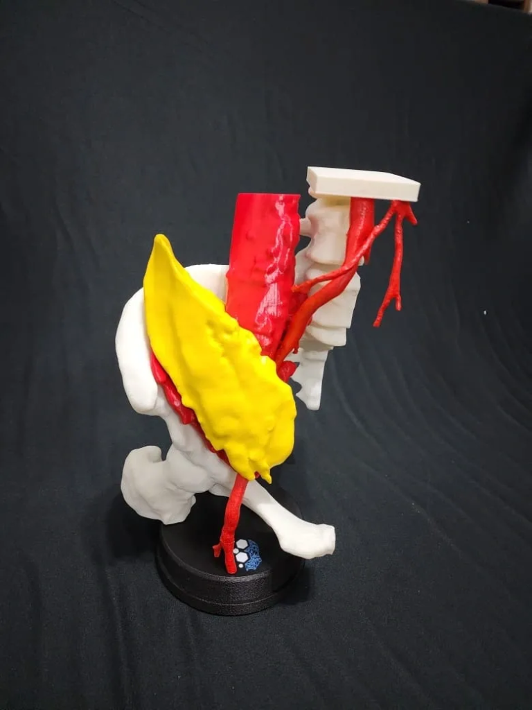 Biomodelo Vascular — Bacia e Aorta