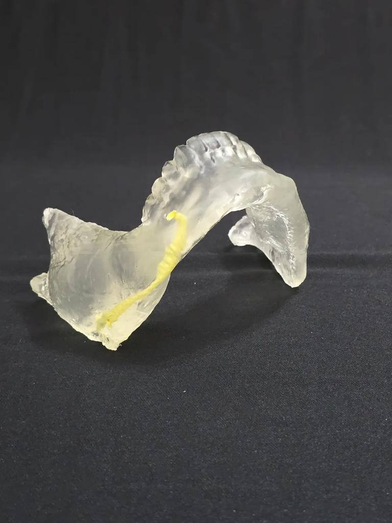 Mandíbula Transparente com Nervo