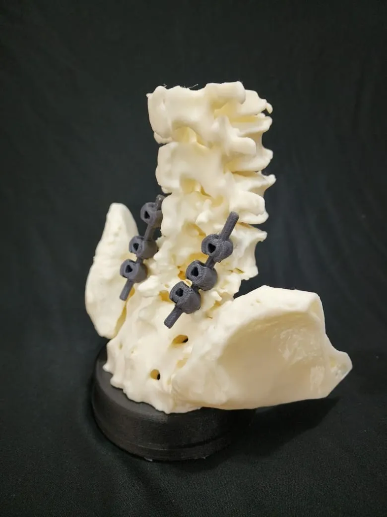 Coluna Cervical com Fixação