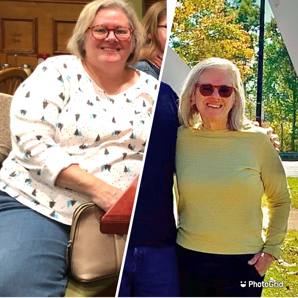 Steenie before and after