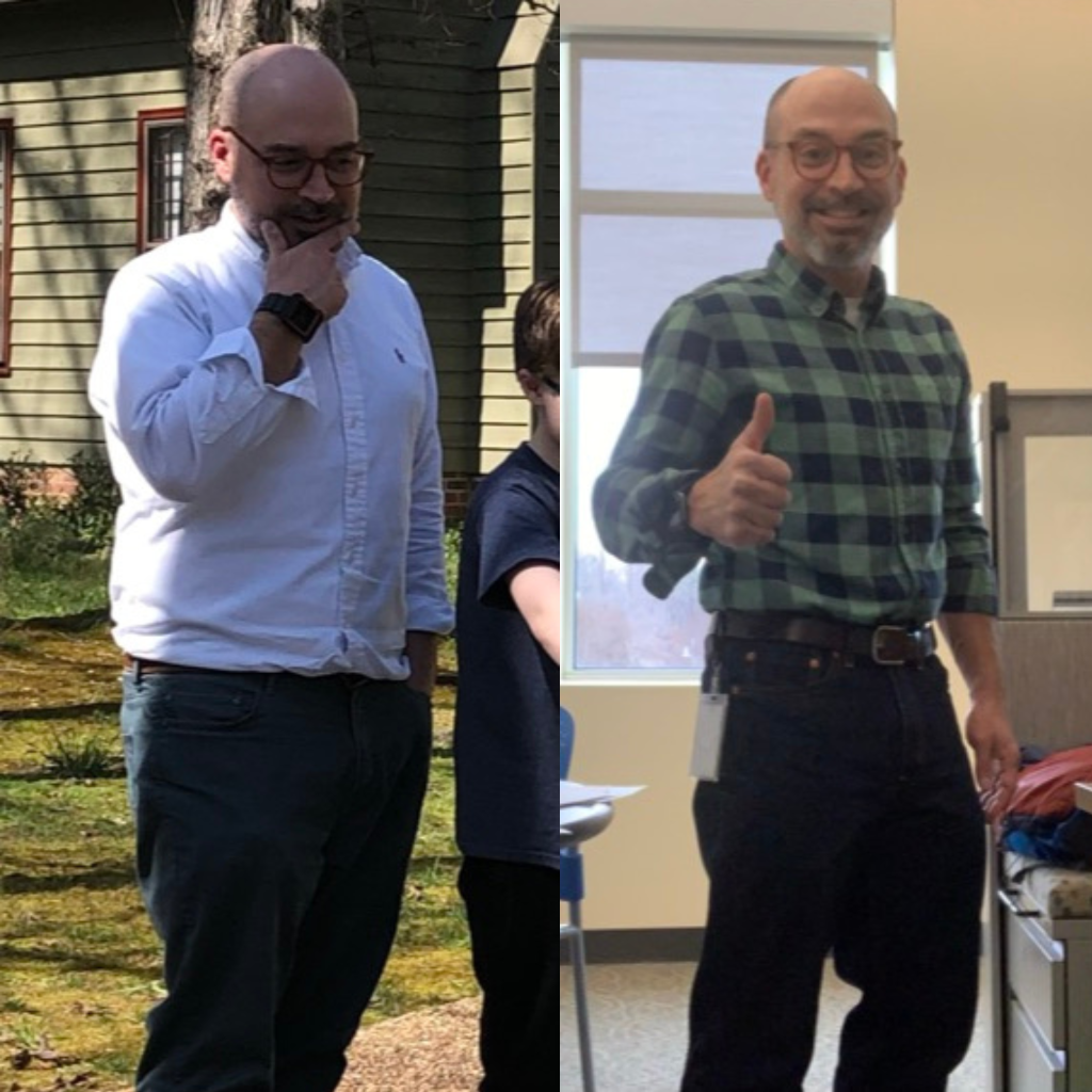 Josh before and after Hope30
