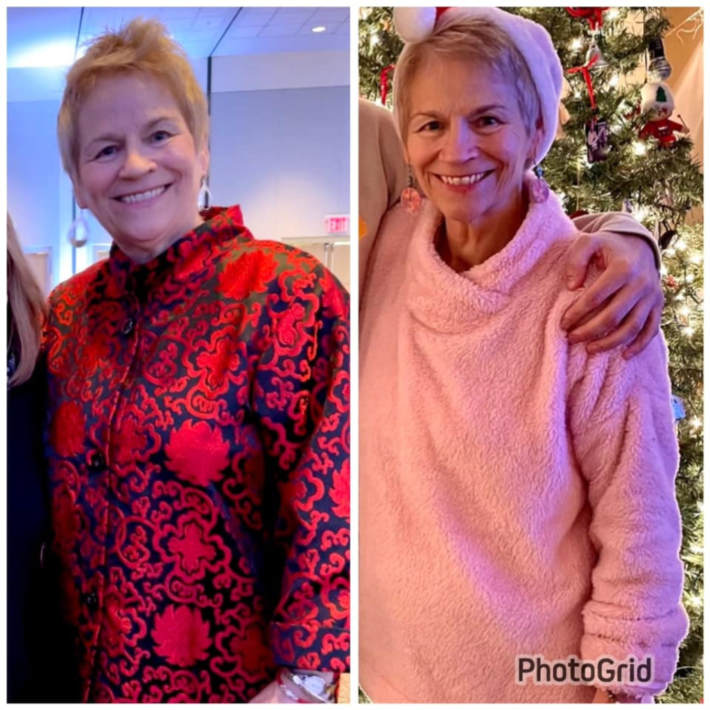 Nancy before and after