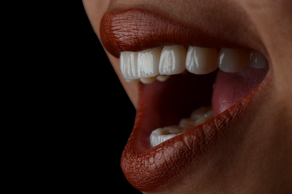 Digitalt smile design