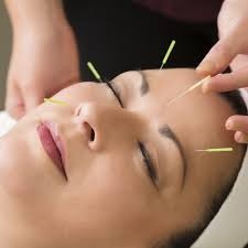 Acupuntura Estética Facial