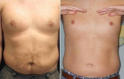 Slimmer, more defined midsection