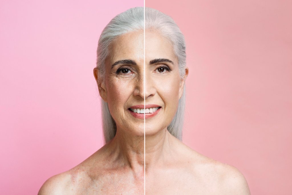 Before and after wrinkle-relaxing treatment portrait
