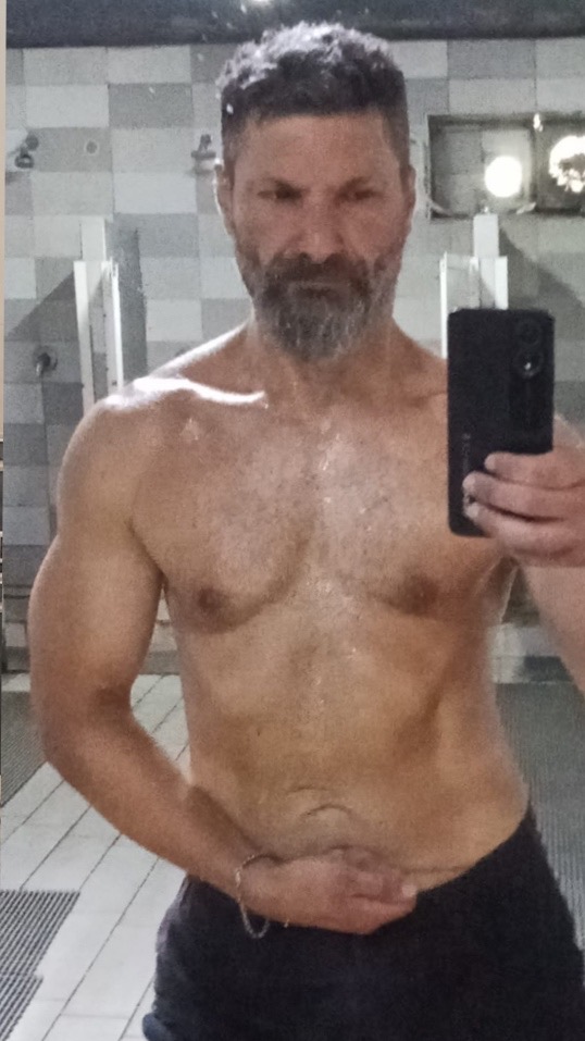 Dopo