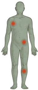 Inflammation Calm