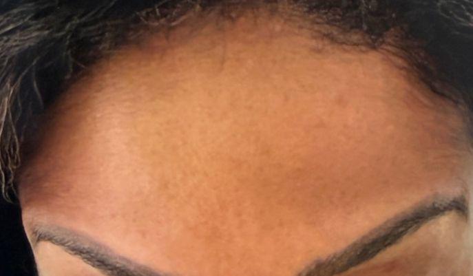 After