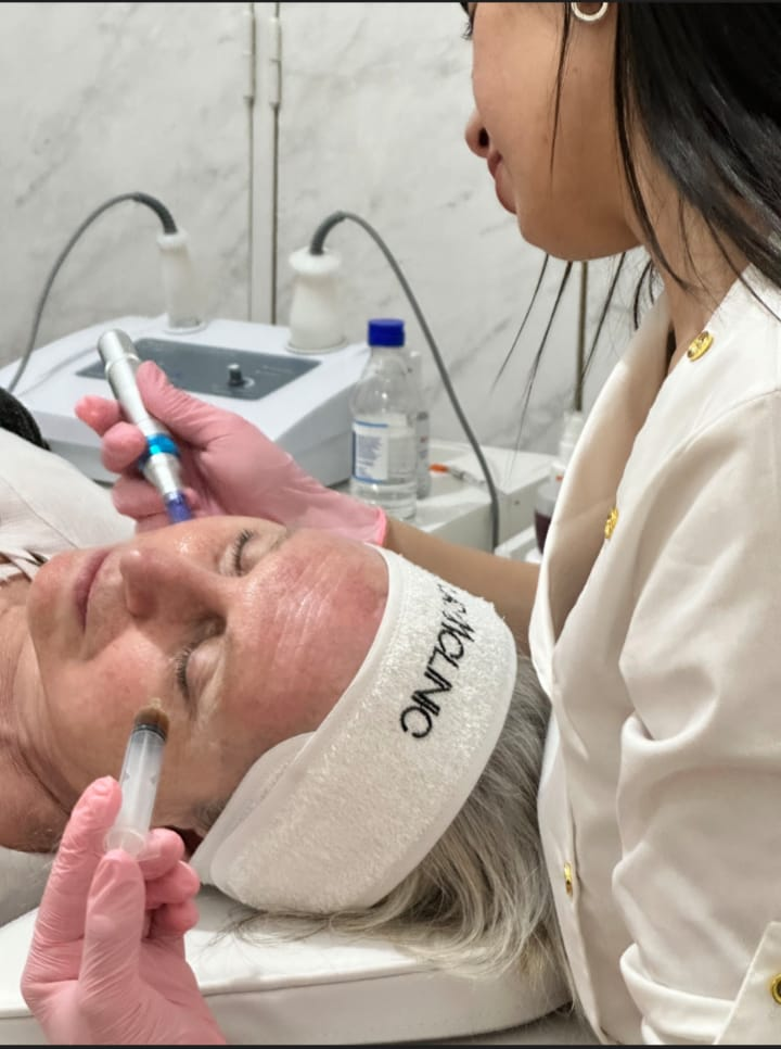 Microneedling (Dermapen)
