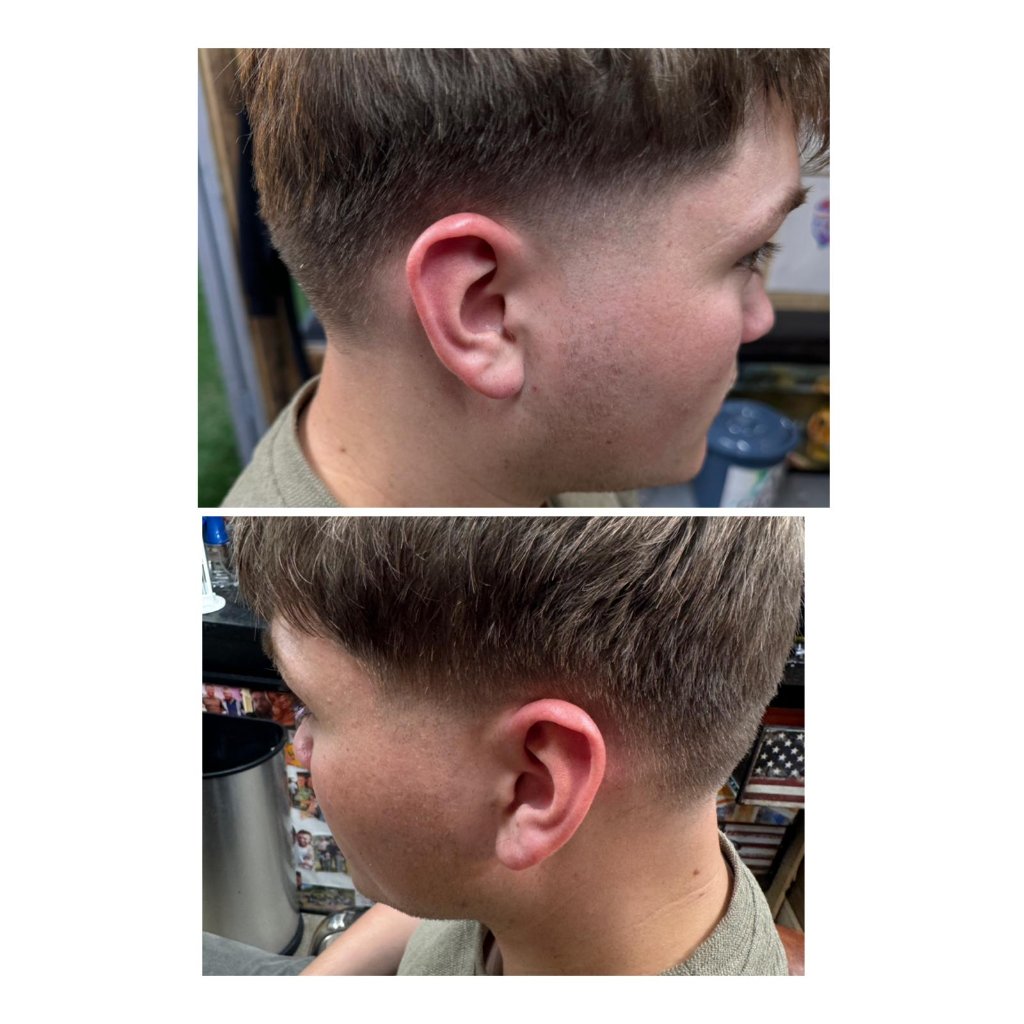 Before & After Transformation