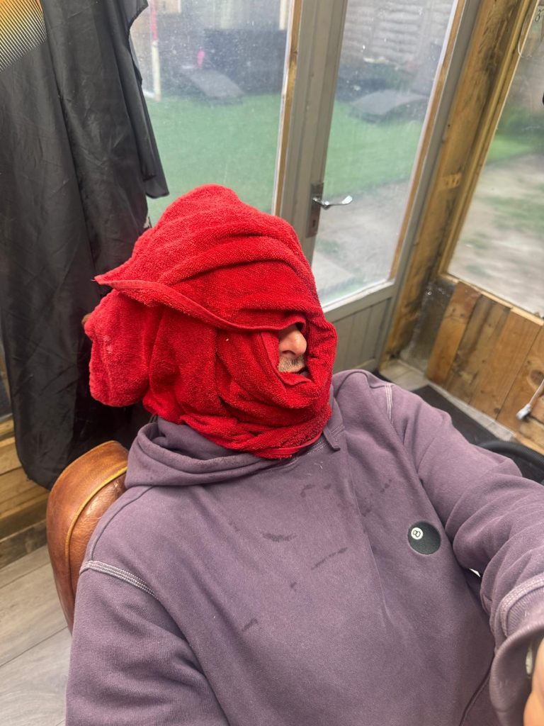 Hot Towel Treatment