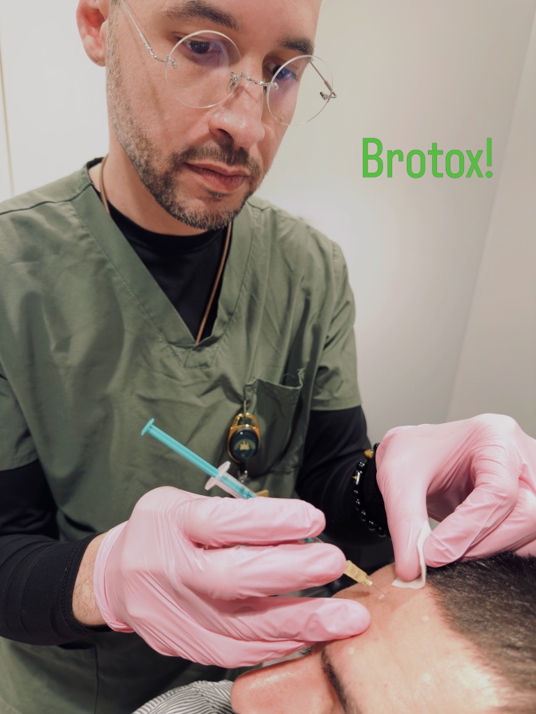 Frontalis neurotoxin treatment — Brotox
