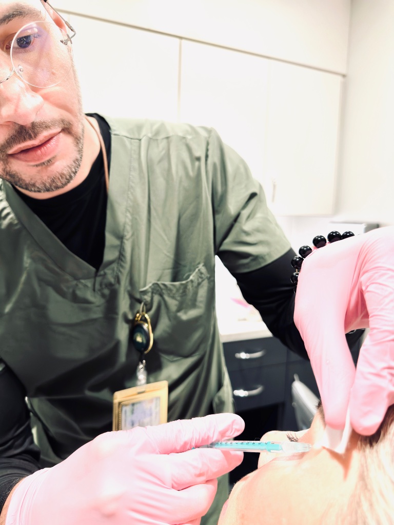 Crow's feet treatment