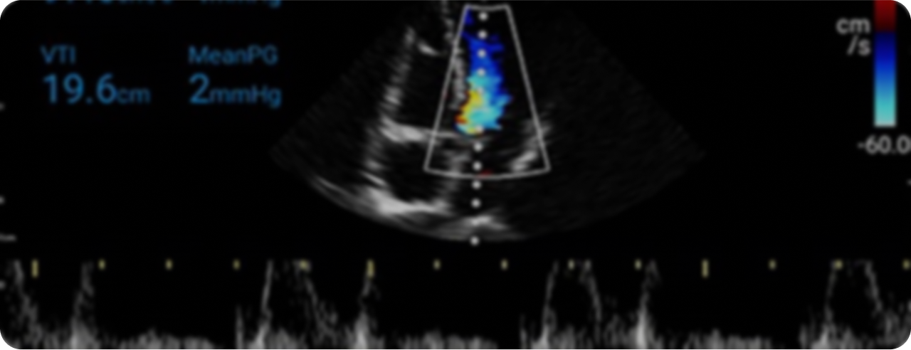 Lumify Ultrasound Device