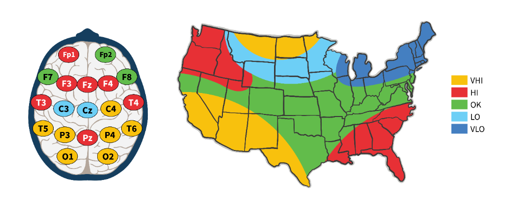 Brain Map showing regional activity