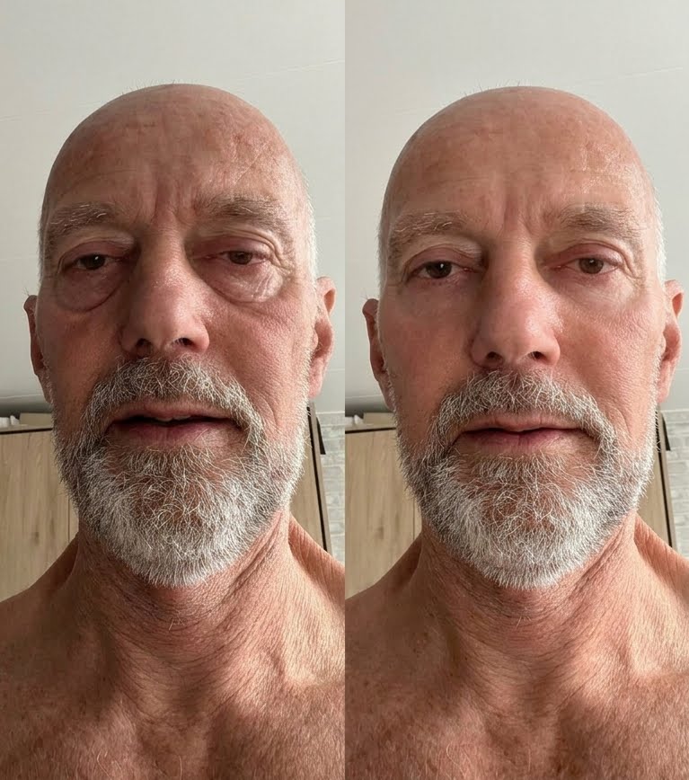 résultat