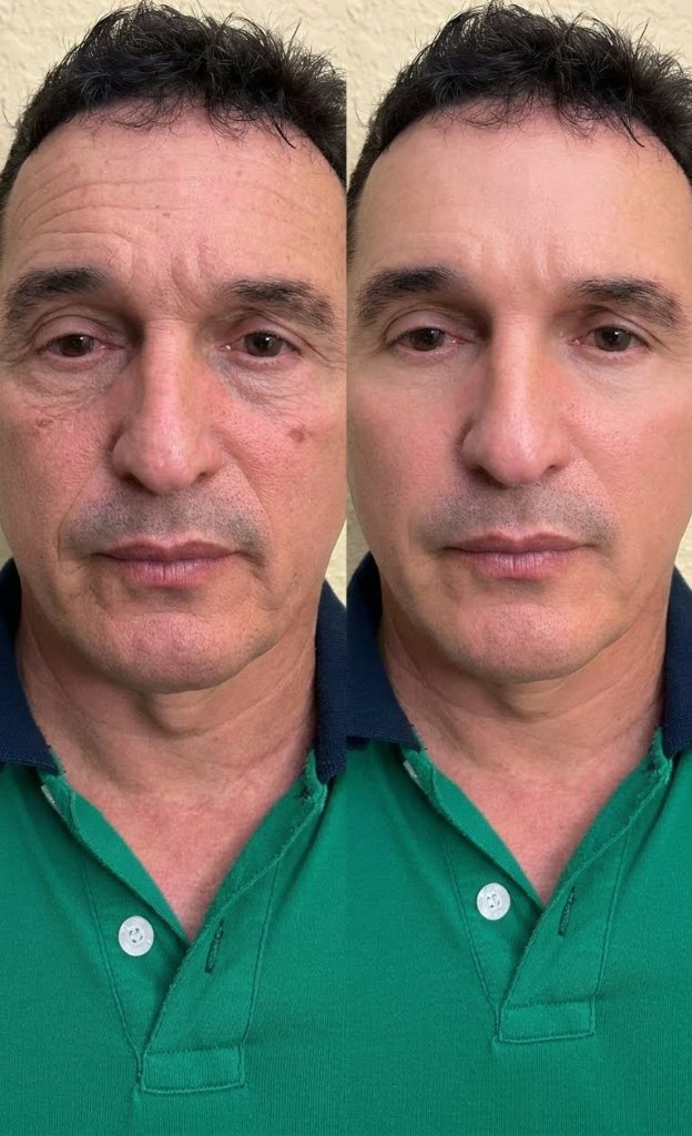 résultat
