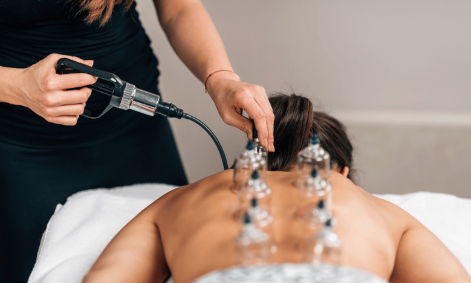 Cupping Therapy
