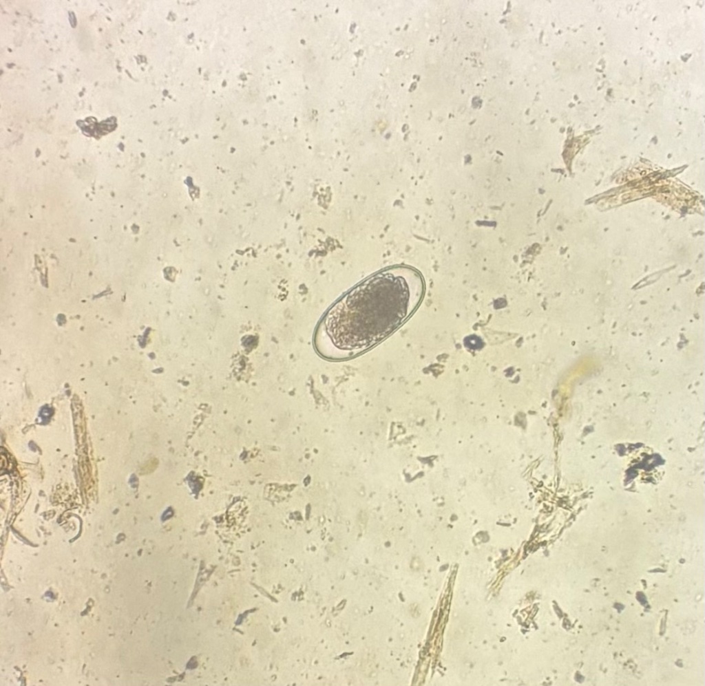Microscope image of a parasite egg from a fecal sample