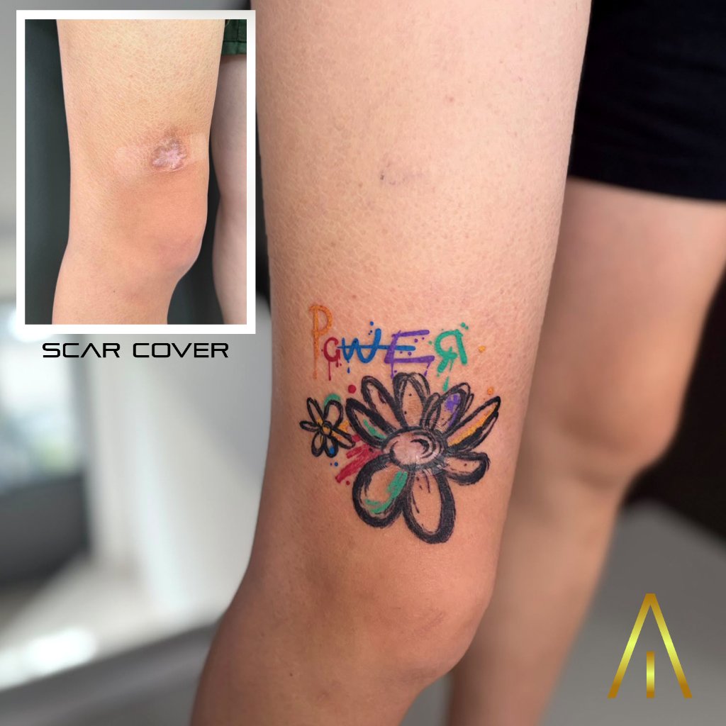 Scar cover daisy POWER tattoo on thigh Chiang Mai