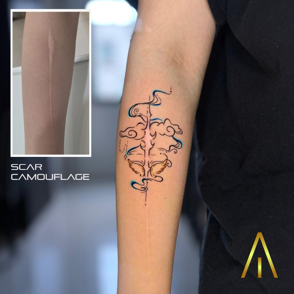 Cover up tattoo Chiang Mai
