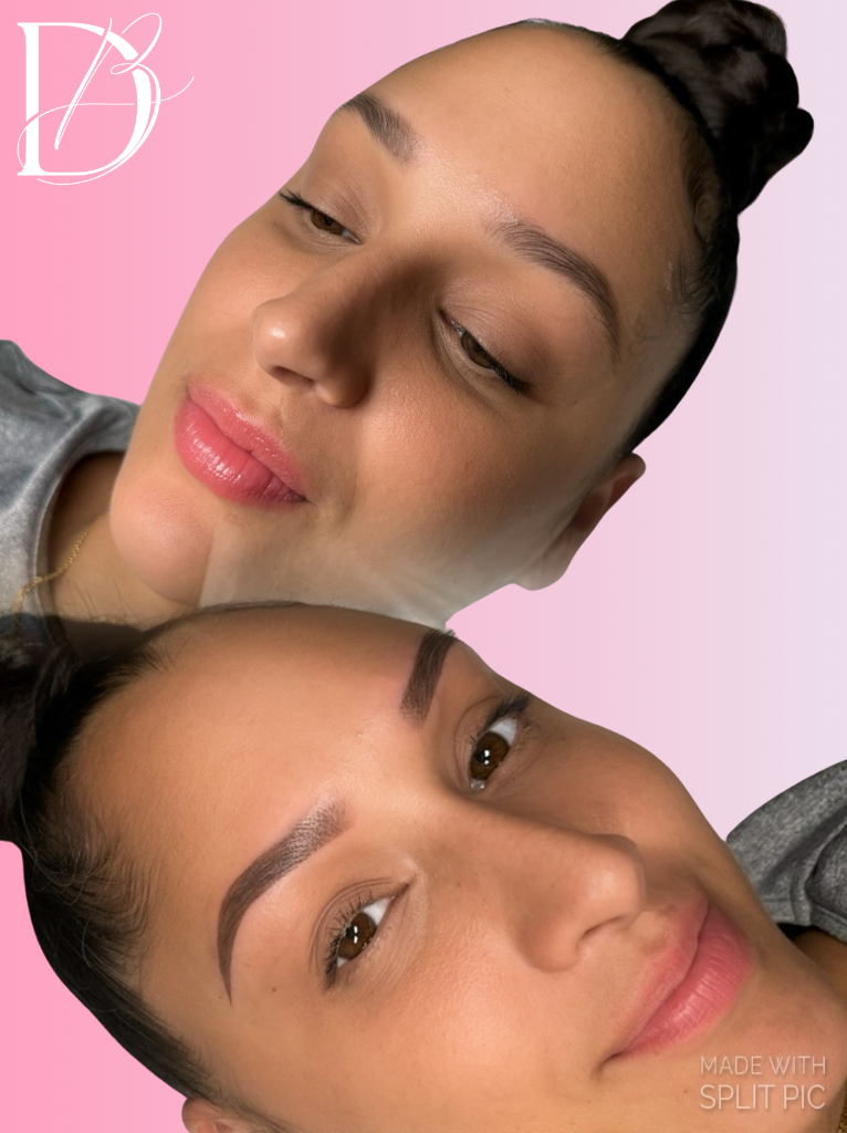 Healed Brow Results