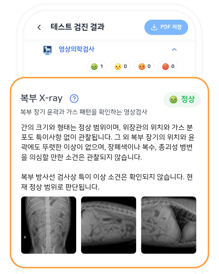 검진 결과 화면