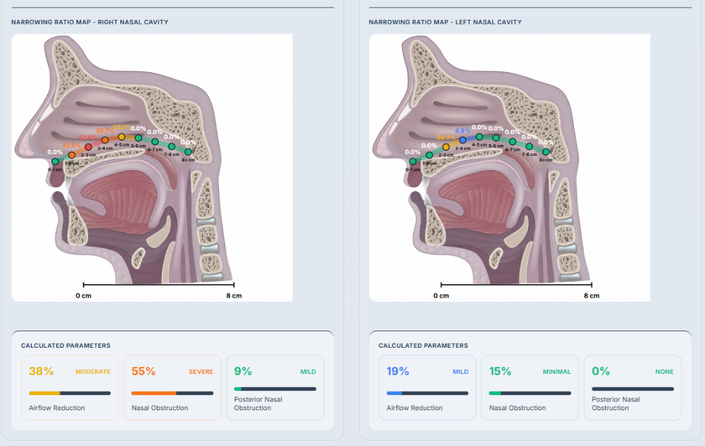 Odiosoft-Rhino Clinical Report