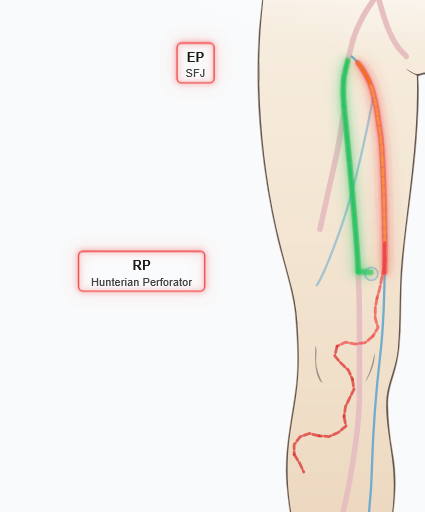 Hemodynamic strategy with CHIVA